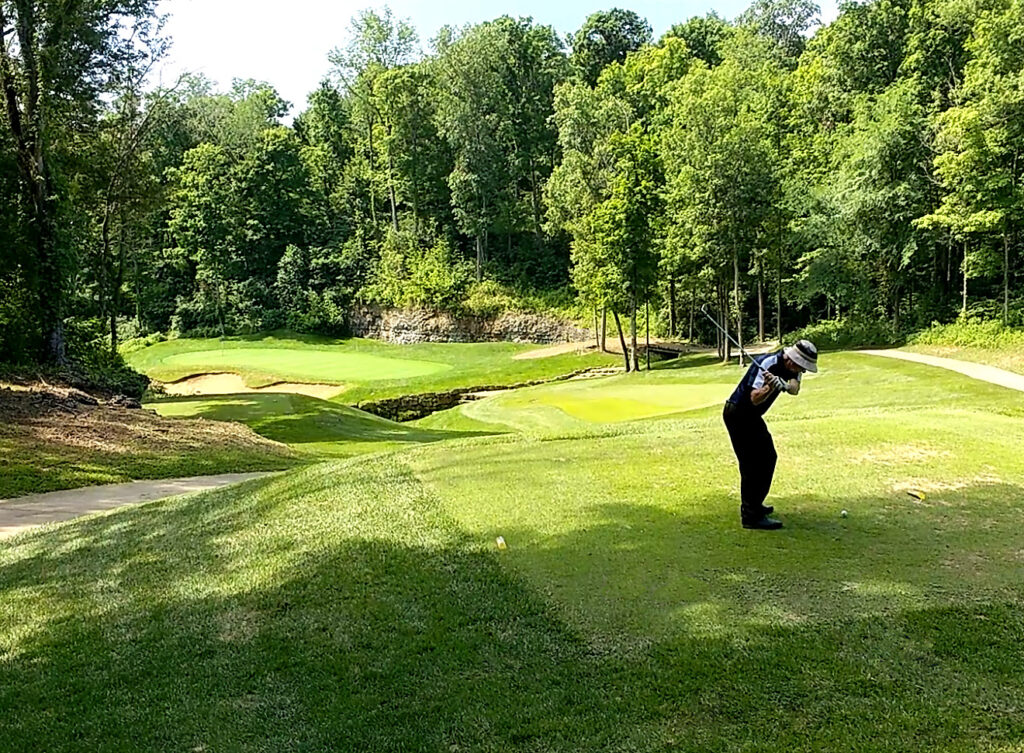 A person in a hat prepares to swing a golf club on a green course surrounded by trees under a clear sky.